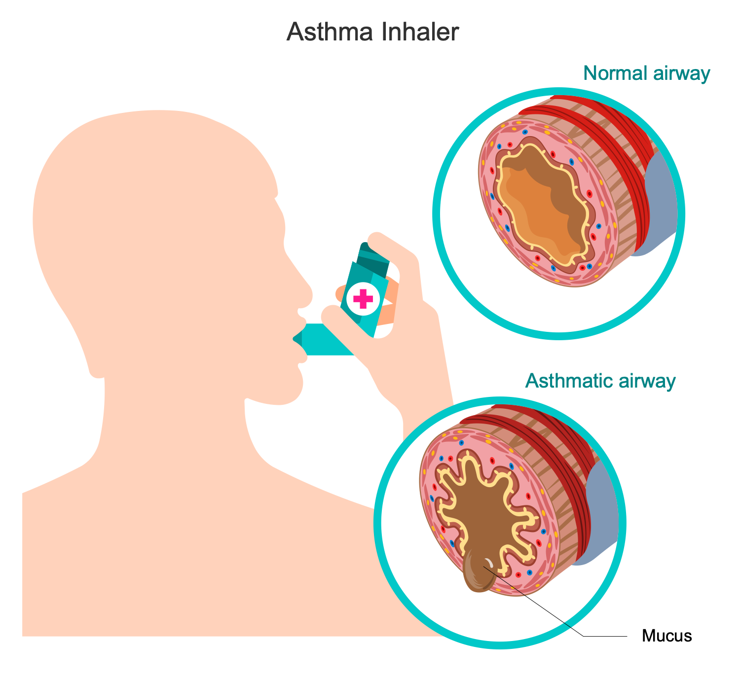 Asthma Inhaler